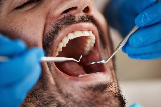 Best Broken Tooth Emergency  in Hamburg, NJ